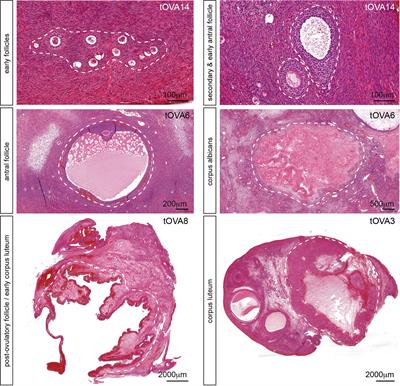 Dynamic in vitro culture of cryopreserved-thawed human ovarian cortical tissue using a microfluidics platform does not improve early folliculogenesis